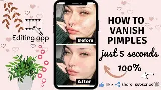 how to vanish pimples in photos / EDITING APP in just 5 second