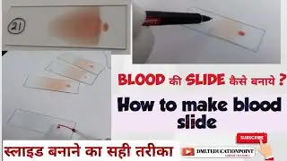 blood की slide कैसे बनाये| slide kaise bnaye | Hematology-Making a paripheral Blood smear #slide