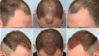 estetikmed05398920770