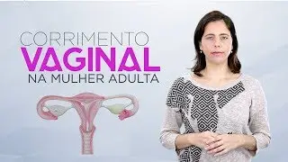 Principais Causas de Corrimento Vaginal