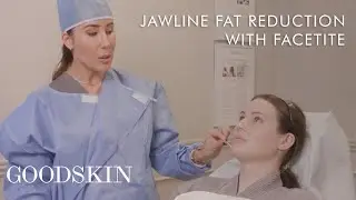 Jawline Fat Reduction with Facetite  — Inside The Treatment Room | GOODSKIN