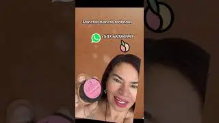 Manchitas blancas redondas? Detenlas ya!