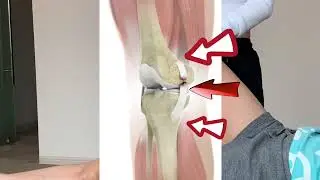 Treatment for MCL sprain
