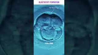 Real footage of Blastocyst Formation under microscope |  Human Embryo Development Stages 