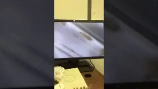 Dance of the Daphnia