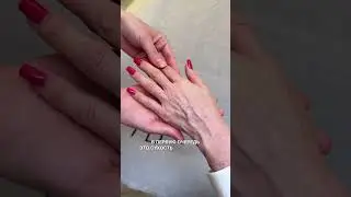 РУКИ ВЫДАЮТ ВАШ ВОЗРАСТ?