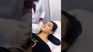 Girl 😱 Dimples Surgery 😱 Girl Happy Mood 