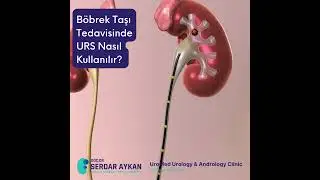 URS, ÜRETER TAŞI, BÖBREK TAŞI, LAZER TAŞ KIRMA. DOÇ DR SERDAR AYKAN