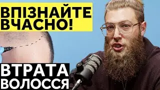 Як Уникнути Випадіння Волосся? Топ 4 Види Алопецій