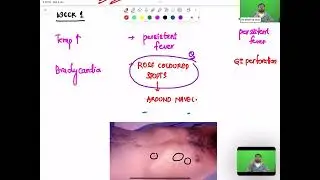 Microbiology class -part 12 by Dr Krishna Sahith