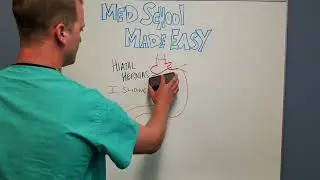 Types of Hiatal Hernias: High-Yield Review