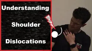 Understanding Shoulder Dislocations