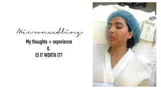 Microneedling Vlog! MY thoughts + experiences!