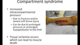 Orthopaedic trauma for med students 3