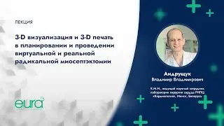 3D визуализация и 3D печать в планировании и проведении виртуальной и реальной миосептэктомии