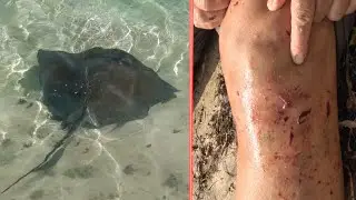 Атака ската. Купание с морскими скатами опасно.