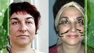 girudocentr 10 20