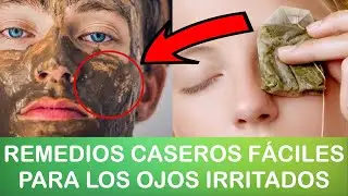 REMEDIOS CASEROS PARA LOS OJOS IRRITADOS | Pro-Eduk@