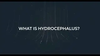 About Hydrocephalus