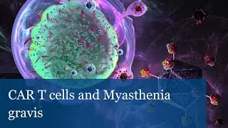 CAR T cells and Myasthenia gravis (Dimitrios Mougiakakos)