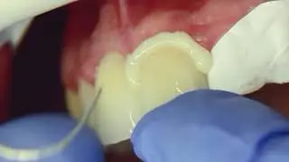 RelyX Universal de 3M