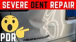 Toyota Highlander Severe Body Damage Repair with Paintless Dent Removal Method