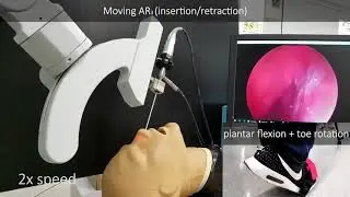 An Endoscope Manipulator Designed for Sinus Surgery (Lab & Clinical Demo)