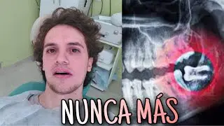 ME SACARON LA MUELA DE JUICIO | Mi experiencia