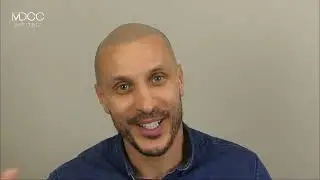 La technique parfaite pour moi: La Dermopigmentation des cheveux