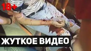 Мужчина Порезал Вены Прохожему В Центре Киева. Видео С Места