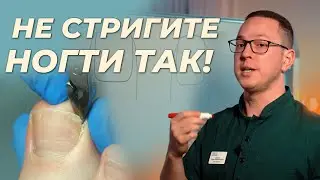 Как подстригать ногти, чтобы не было проблем