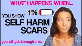 WHAT HAPPENS WHEN YOU SHOW SELF HARM SCARS