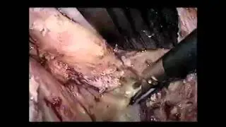 V036: M Hamada, MD