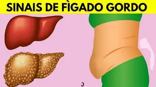Fígado gordo – aqui estão os 13 principais sintomas | RECEITAS NATURAIS