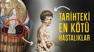 İnsanlık Tarihinin En Yıkıcı Hastalıkları - Biz Yine Şanslıymışız...