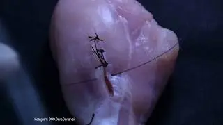Simple suture technique