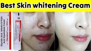 Skin whitening cream without side effects| Skin Lightening Cream| kojic acid| Demelan cream review |