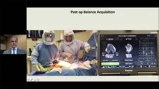 John Keggi MD OMNIBotics®, the robotics soft tissue balancing system
