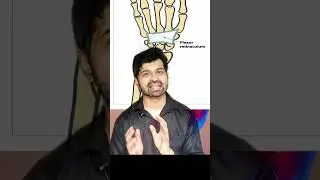 Carpal Tunnel explained in a minute. Carpal Tunnel Syndrome. Median Nerve Compression