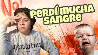 PERDÍ MEDIO LITRO DE SANGRE!! [[ Story Time ]]