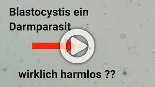 Blastocystis ein Darmparasit - wirklich harmlos ?