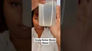 Seborrheic Dermatitis Scalp Detox Waste Water. Keep your scalp healthy with  scalp detox. 