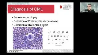 Chronic myeloid leukemia (CML) : What it is how it’s treated and minimizing side effects