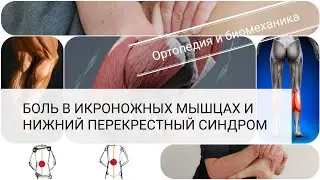 Постоянная боль в ногах / Напряжение мышц голени/ Боль в пояснице/ Терапия/ Pain in the shin area/