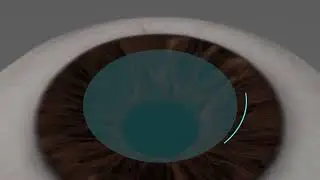 Smartsight Augenlaser Lentikelextraktion Animation Wien & Zürich EyeLaser