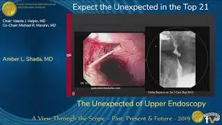 The Unexpected of Upper Endoscopy