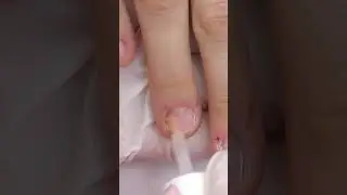 I want French Nails! *On Short Bitten Nails