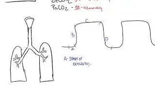 Capnography