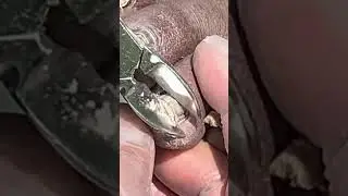 Fix My Feet