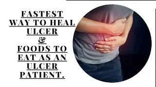 This HEALS *STOMACH ULCERS* way FASTER // TYPES of *FOOD🍽,DRINKS🥂TO EAT* as an ULCER PATIENT.
